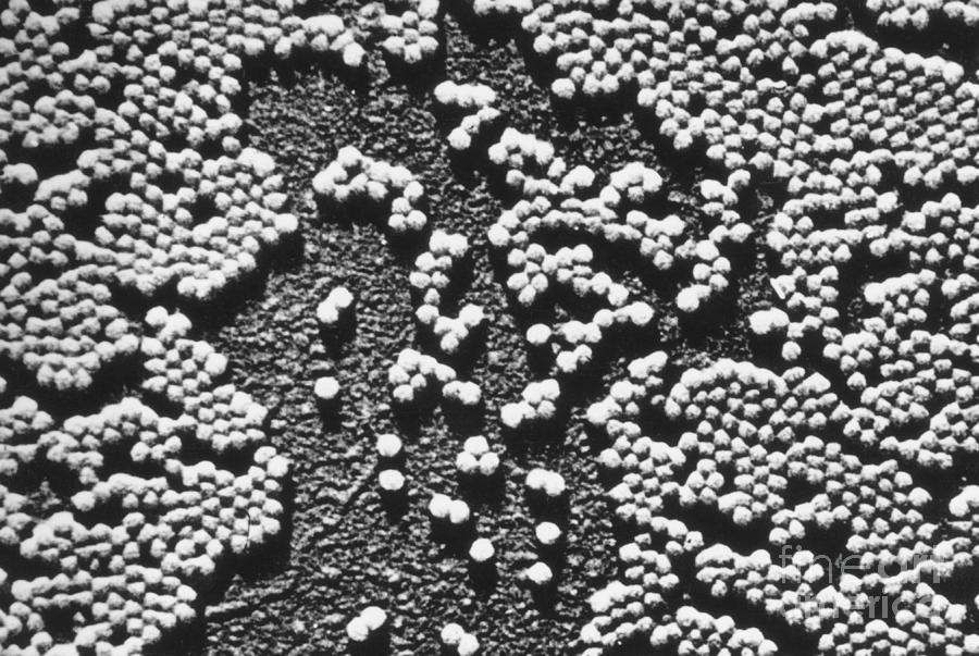 Polio Virus, Tem #2 Photograph by Omikron