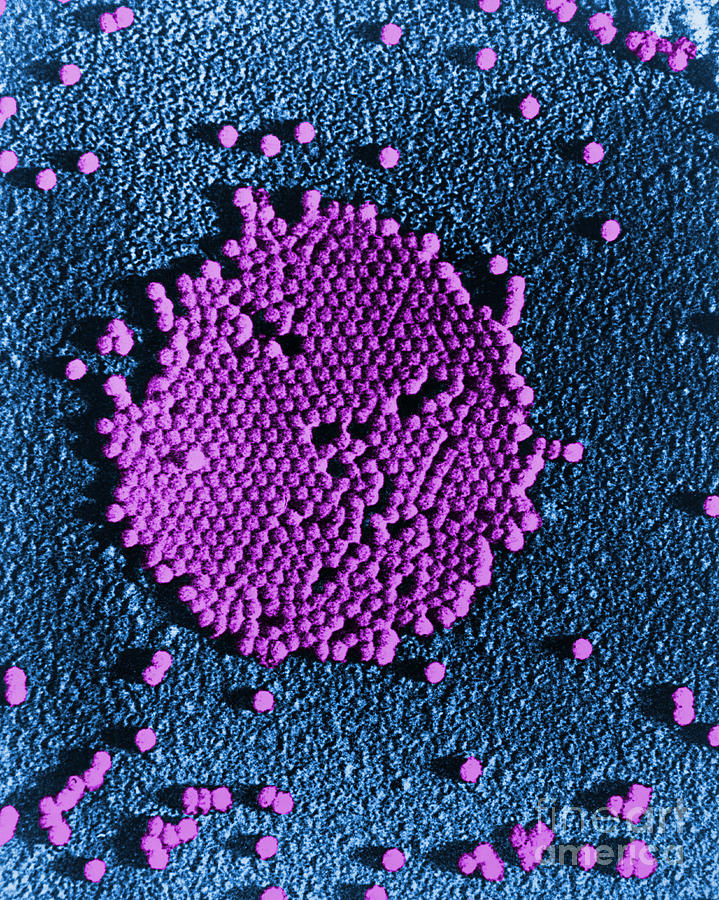 Poliovirus, Tem #2 Photograph by Science Source