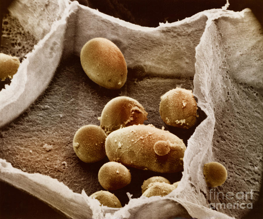 Potato Cell With Starch Granules #2 Photograph by Omikron