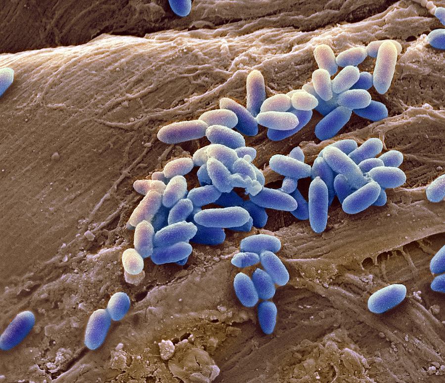 Бактерии бак. Бактерия Pseudomonas aeruginosa. Pseudomonas aeruginosa (синегнойная палочка). Бактерия псевдомонас аэругиноза что это. Синегнойная палочка под микроскопом.