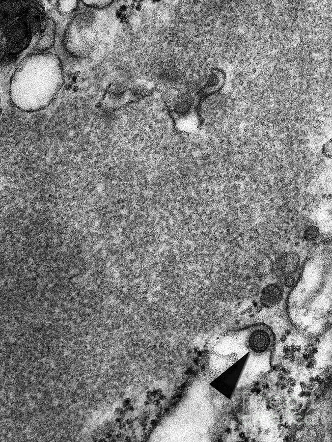Rabies Virus, Tem #2 Photograph by Science Source