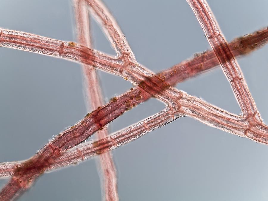 Nature Photograph - Red Algae, Light Micrograph #2 by Gerd Guenther
