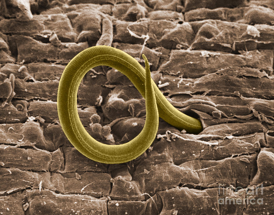 Root Knot Nematode Sem #4 Photograph by Science Source