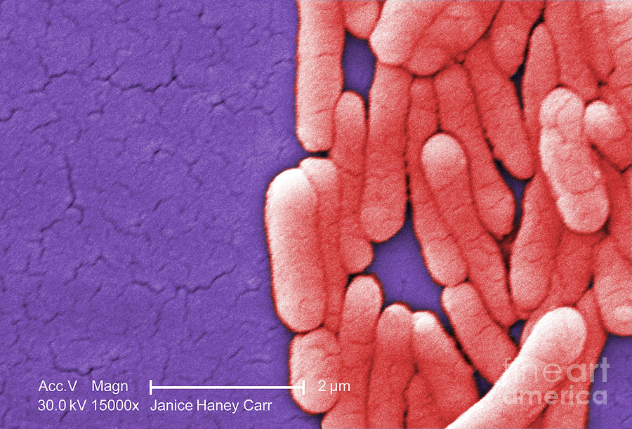 Salmonella, Sem #2 Photograph by Science Source