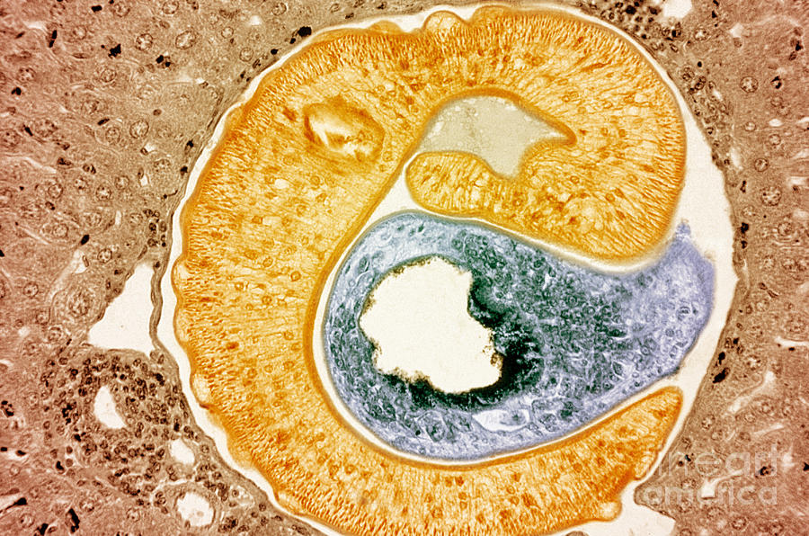 Egg Photograph - Schistosoma Mansoni #2 by M. I. Walker