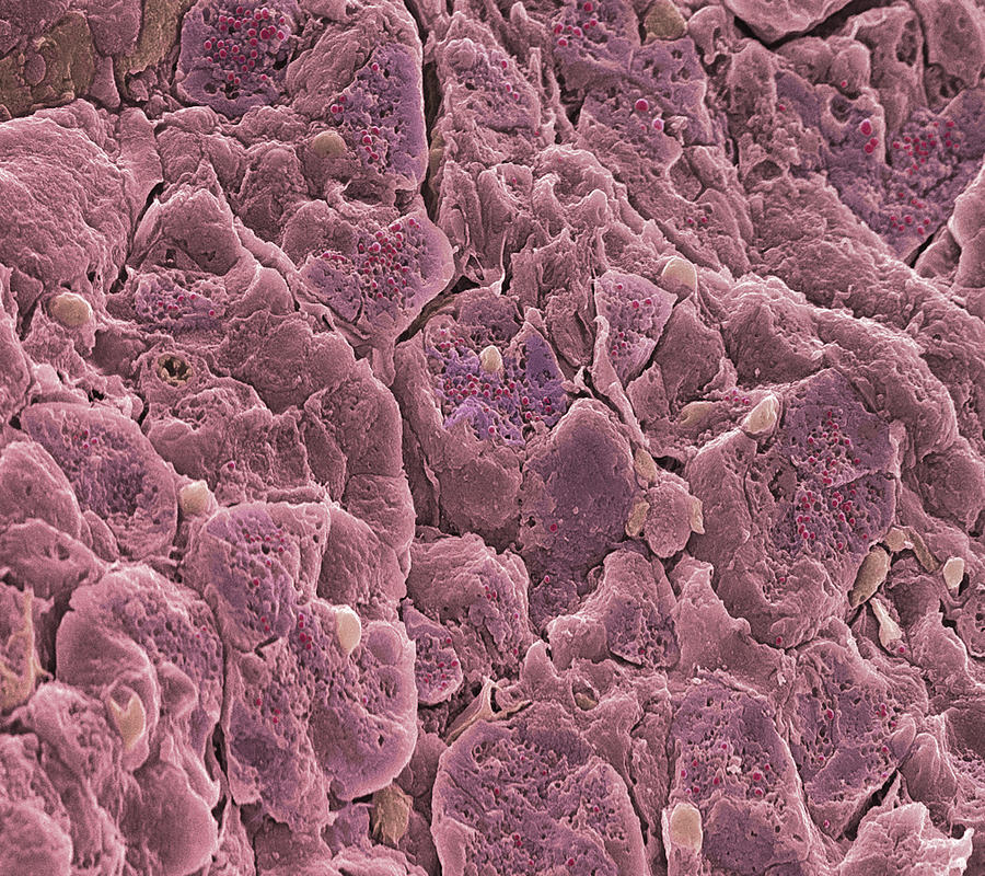 Secretory Cells In Pancreas, Sem Photograph by Steve Gschmeissner ...