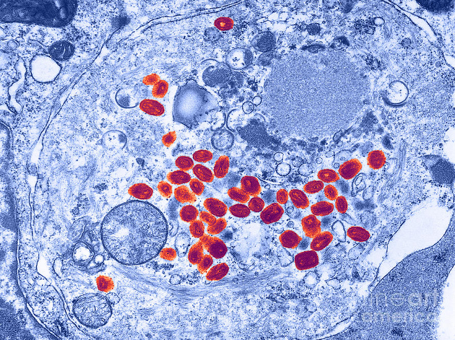 Smallpox Virus, Tem #2 Photograph by Science Source