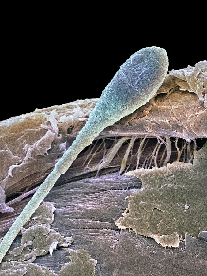 cell Reabsorb sperm