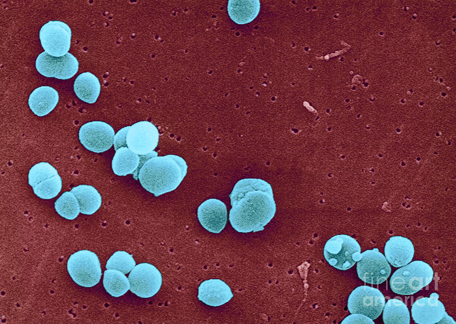 Staphylococcus Aureus Bacteria #2 Photograph by Science Source