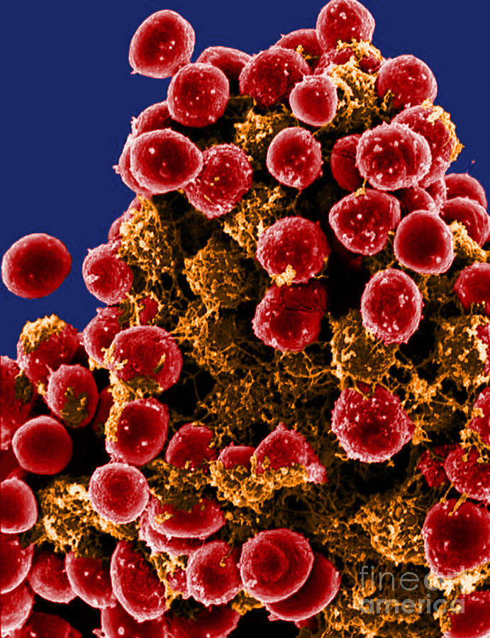 Microbiology Photograph - Staphylococcus Epidermidis Bacteria, Sem #2 by Science Source