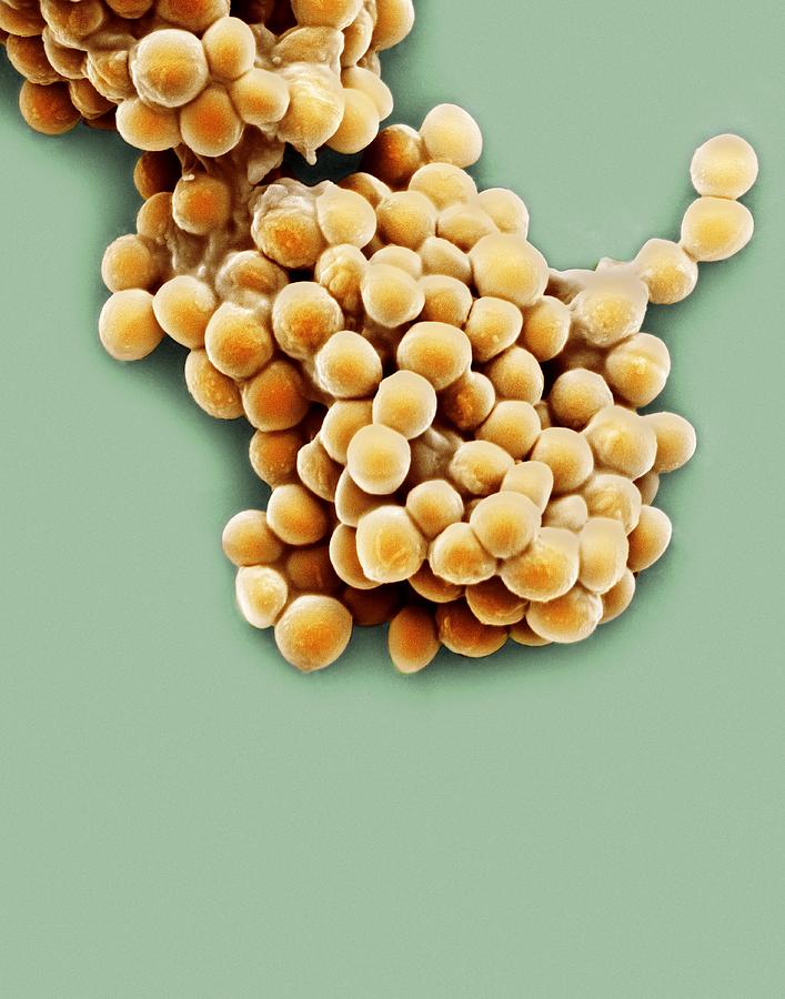 Bacteria Photograph - Streptococcus Thermophilus Bacteria, Sem #2 by Steve Gschmeissner