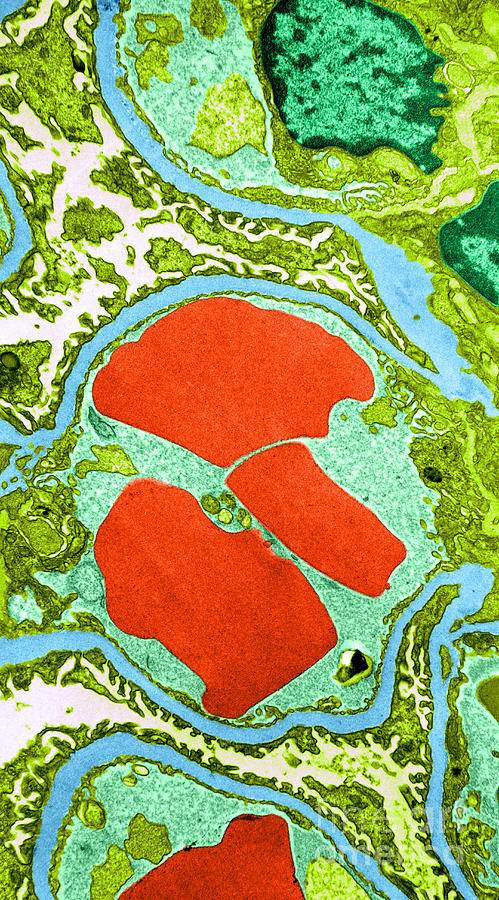 Cell Photograph - Tem Of Glomerulus Capillary Loop #2 by W. Rosenberg