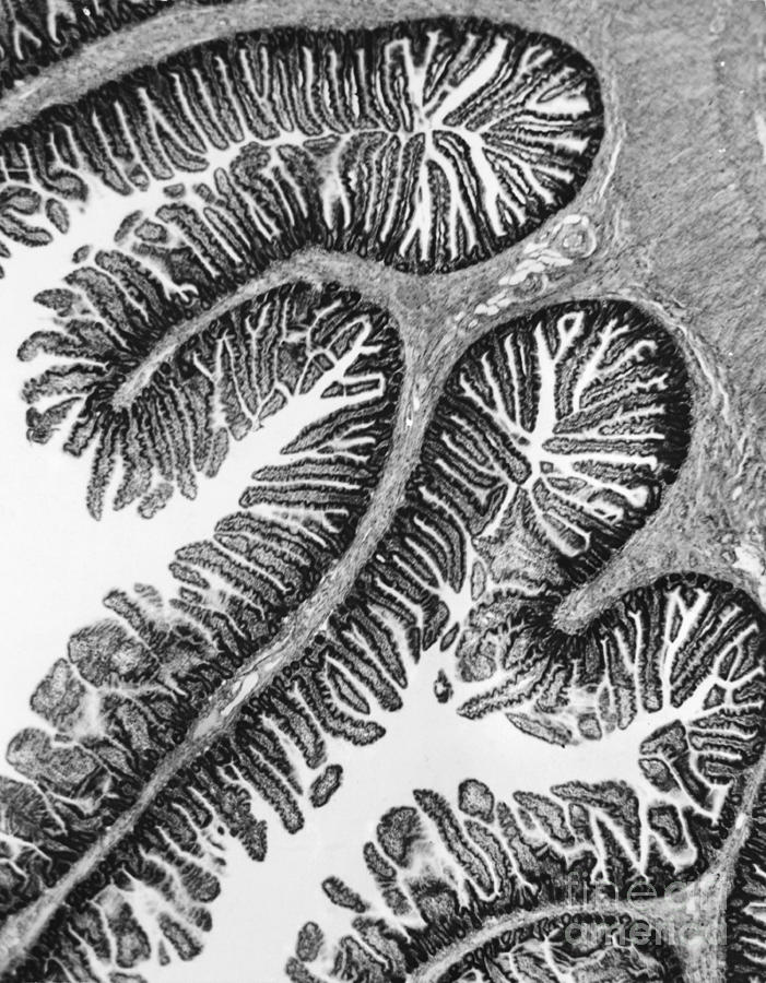 Tem Of Intestines Villi #2 Photograph by Science Source