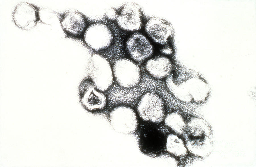 Tem Of Rubella German Measles #2 Photograph by Science Source