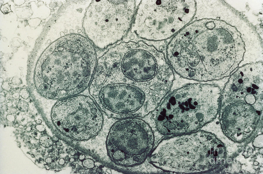Toxoplasma Cyst Tem #2 Photograph by Science Source