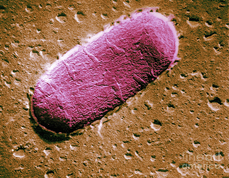 Tuberculosis Bacillum #2 Photograph by Science Source