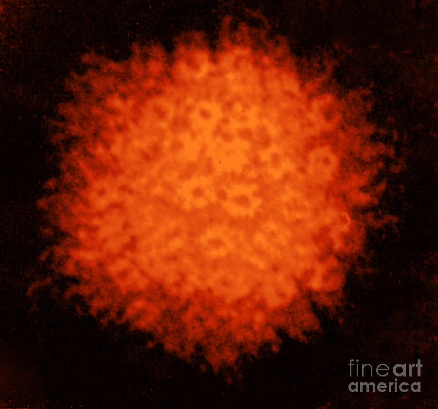 Varicella-zoster Virus #2 Photograph by Science Source