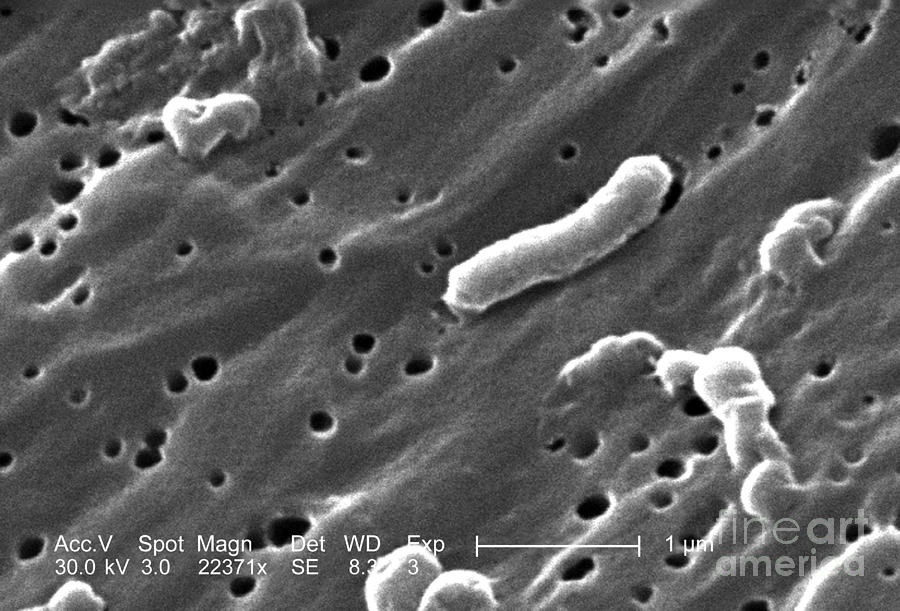 Vibrio Cholerae Bacteria, Sem #2 Photograph by Science Source