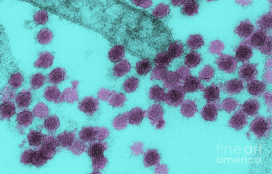 West Nile Virus, Tem #2 Photograph by Science Source