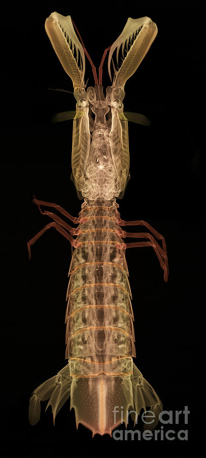 X-ray Of Mantis Shrimp #2 Photograph by Ted Kinsman