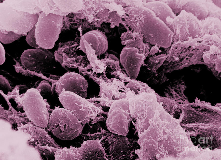 Yersinia Pestis Bacteria, Sem #2 Photograph by Science Source