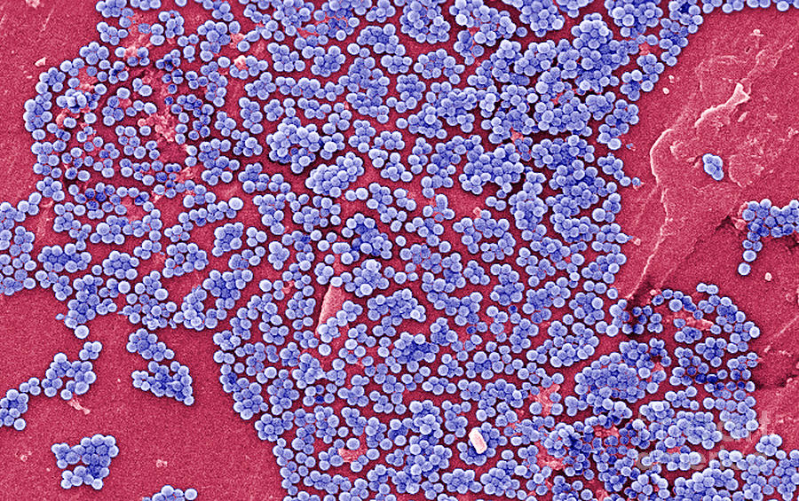 Methicillin-resistant Staphylococcus #20 Photograph by Science Source
