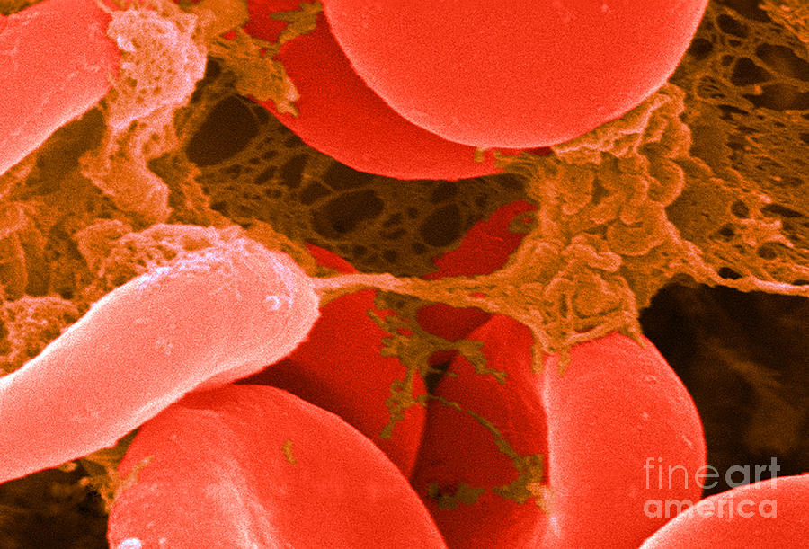 Red Blood Cells, Sem #20 Photograph by Science Source