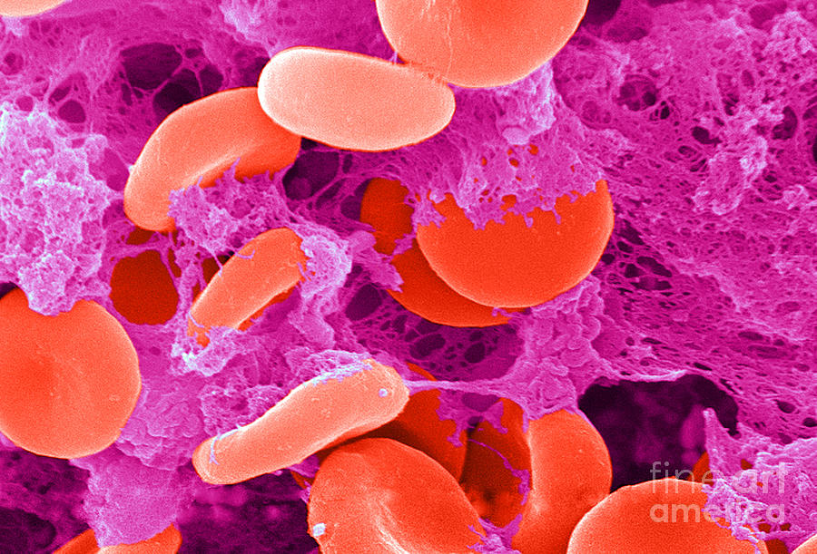 Red Blood Cells, Sem #21 Photograph by Science Source
