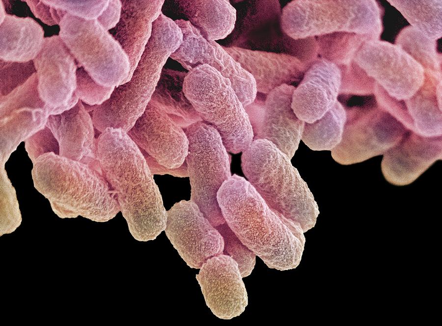 Escherichia Coli Photograph - E. Coli Bacteria, Sem #22 by Steve Gschmeissner