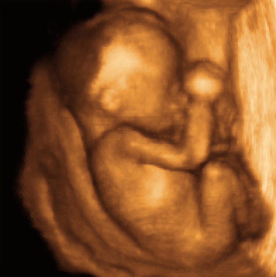 22 Week Foetus, 3-d Ultrasound Scan Photograph by Dr Najeeb Layyous
