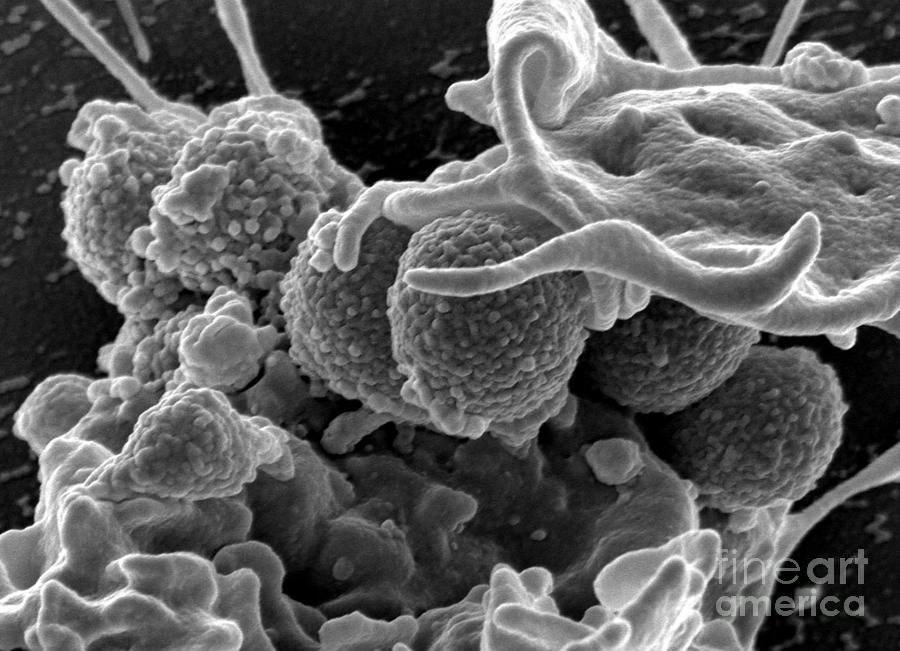 Microbiology Photograph - Methicillin-resistant Staphylococcus #23 by Science Source