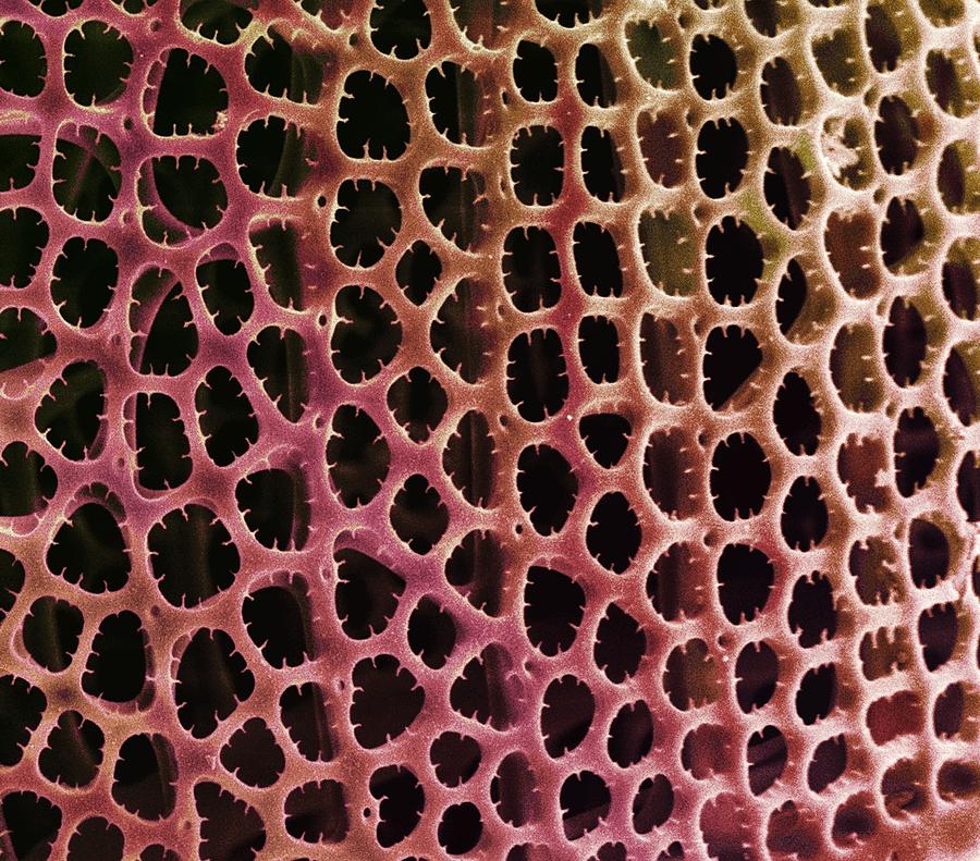 Nature Photograph - Diatom Alga, Sem #24 by Steve Gschmeissner