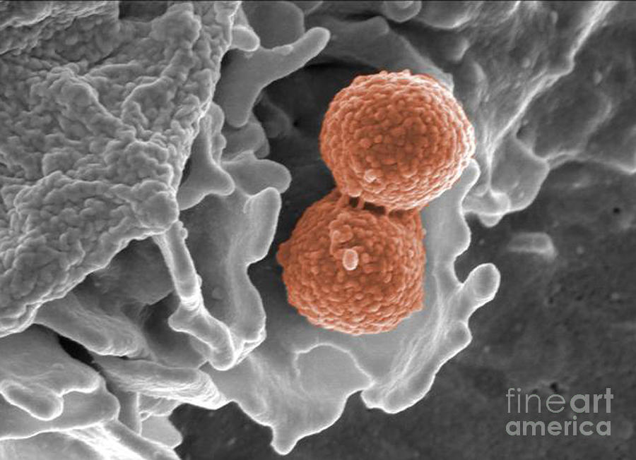 Methicillin-resistant Staphylococcus #24 Photograph by Science Source