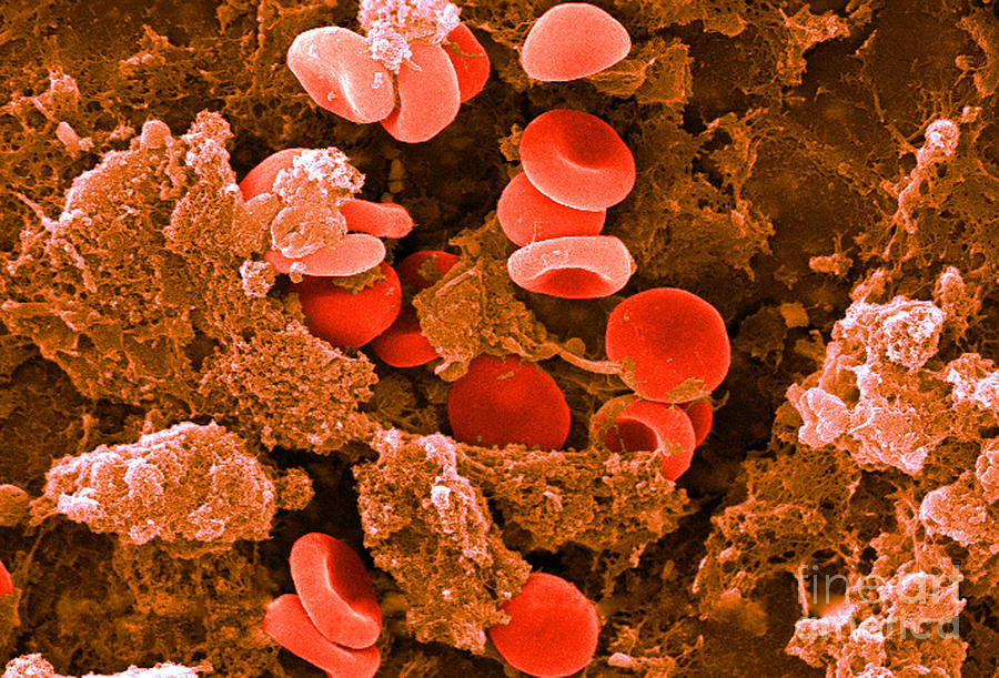 Red Blood Cells, Sem #24 Photograph by Science Source