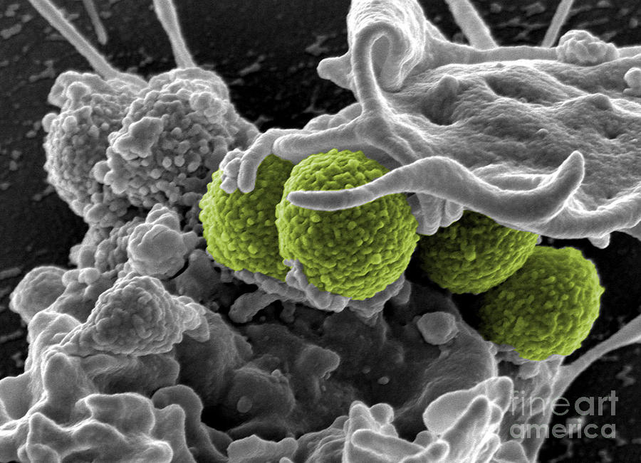 Methicillin-resistant Staphylococcus #25 Photograph by Science Source