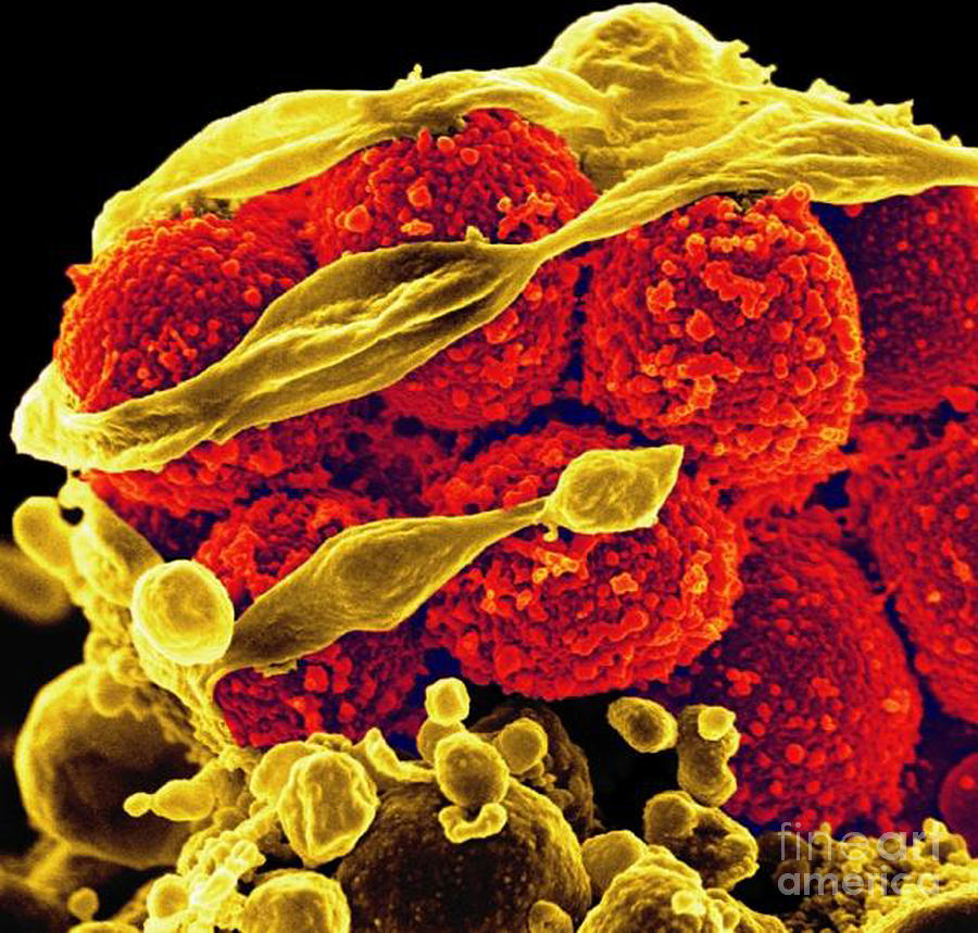 Methicillin-resistant Staphylococcus #26 Photograph by Science Source