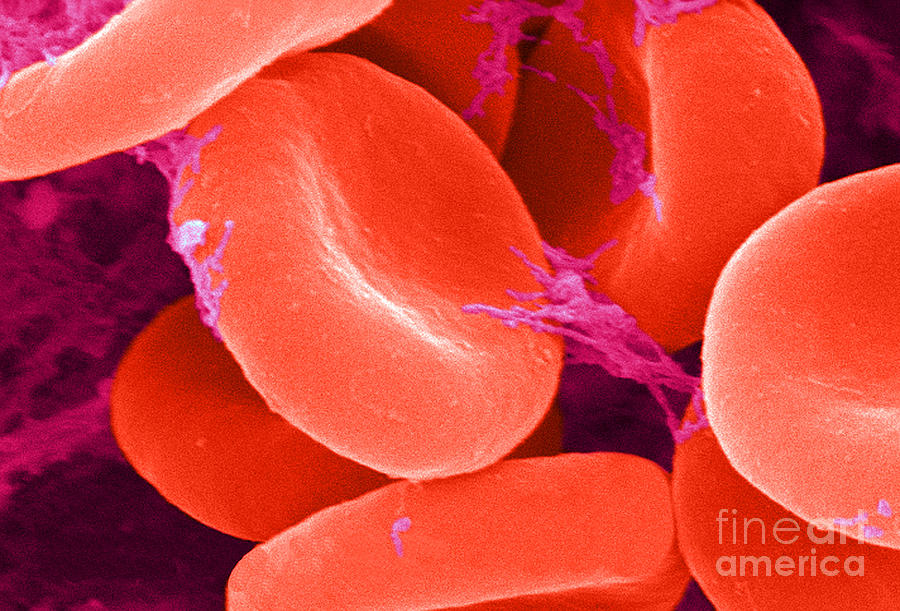 Red Blood Cells, Sem #26 Photograph by Science Source