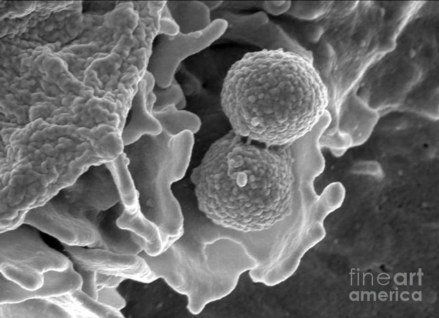 Methicillin-resistant Staphylococcus #27 Photograph by Science Source