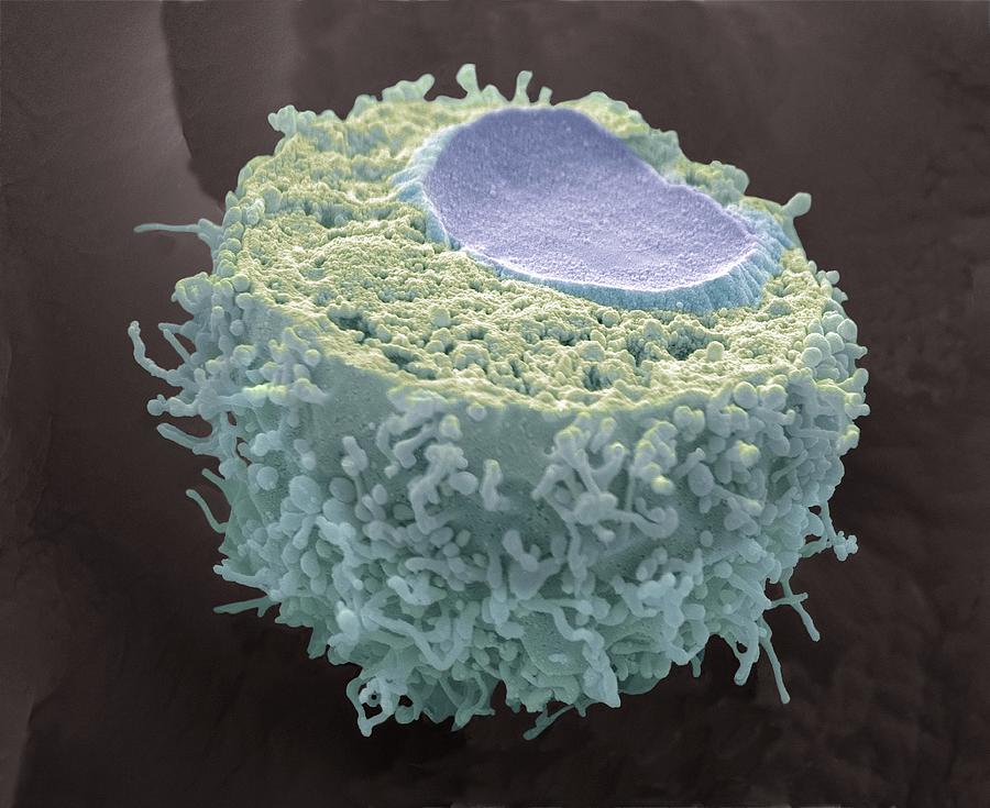 Cervical Cancer Cell Sem Photograph By Steve Gschmeissner Fine Art America