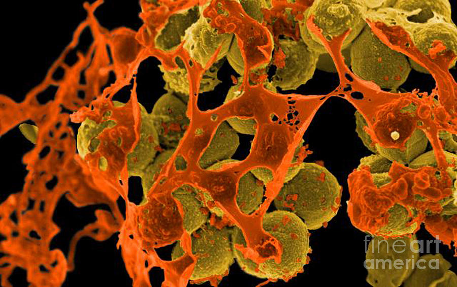 Methicillin-resistant Staphylococcus #29 Photograph by Science Source