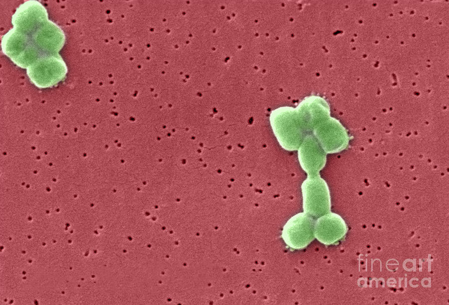 Acinetobacter Baumannii Bacteria, Sem #3 Photograph by Science Source