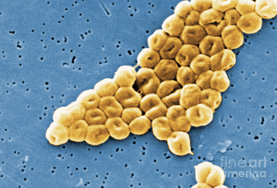 Acinetobacter Baumannii, Sem #3 Photograph by Science Source
