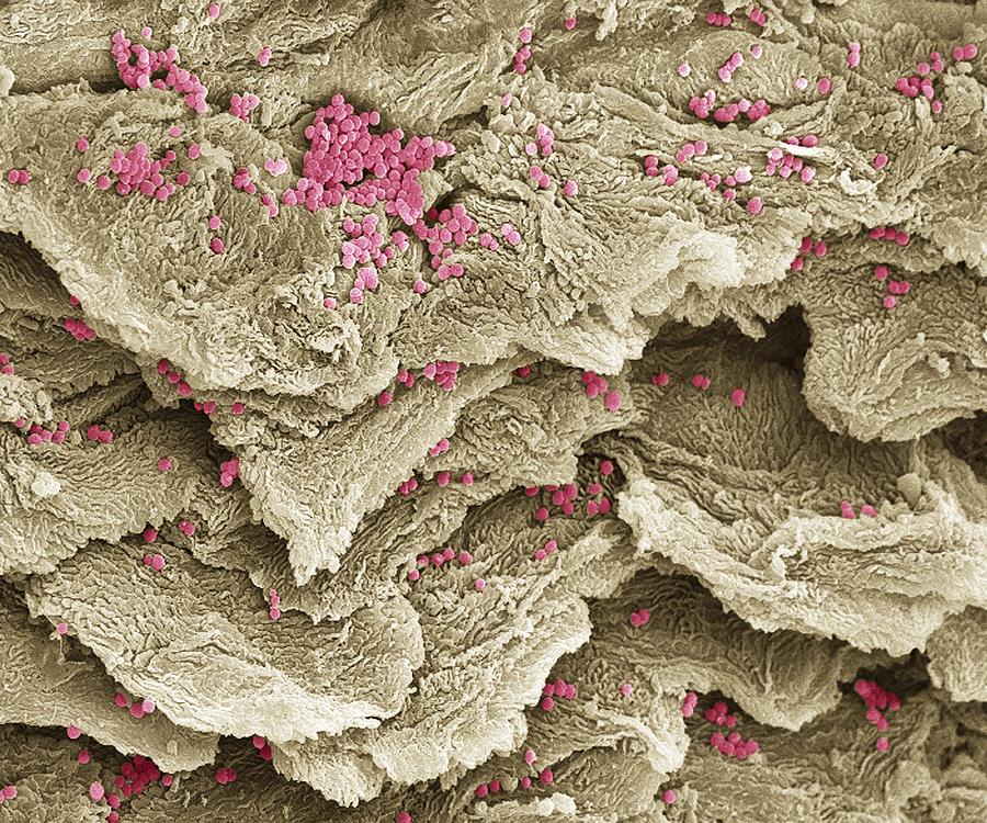 All 90+ Images what does athlete’s foot look like under a microscope Superb