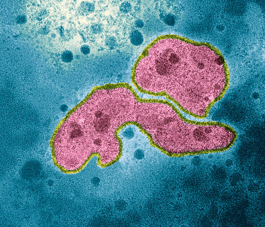 Avian Influenza Virus, Tem Photograph by Nibsc - Fine Art America