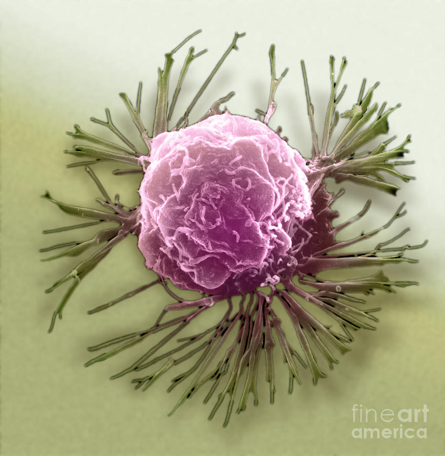 Breast Cancer Cell, Sem #4 Photograph by Science Source