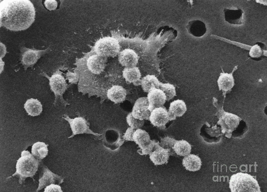 Cancer Cell Death, Sem 2 Of 6 #4 Photograph by Science Source