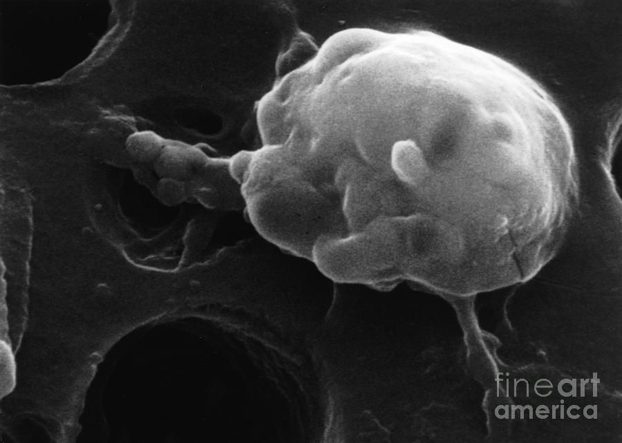 Cancer Cell Death, Sem 5 Of 6 #3 Photograph by Science Source