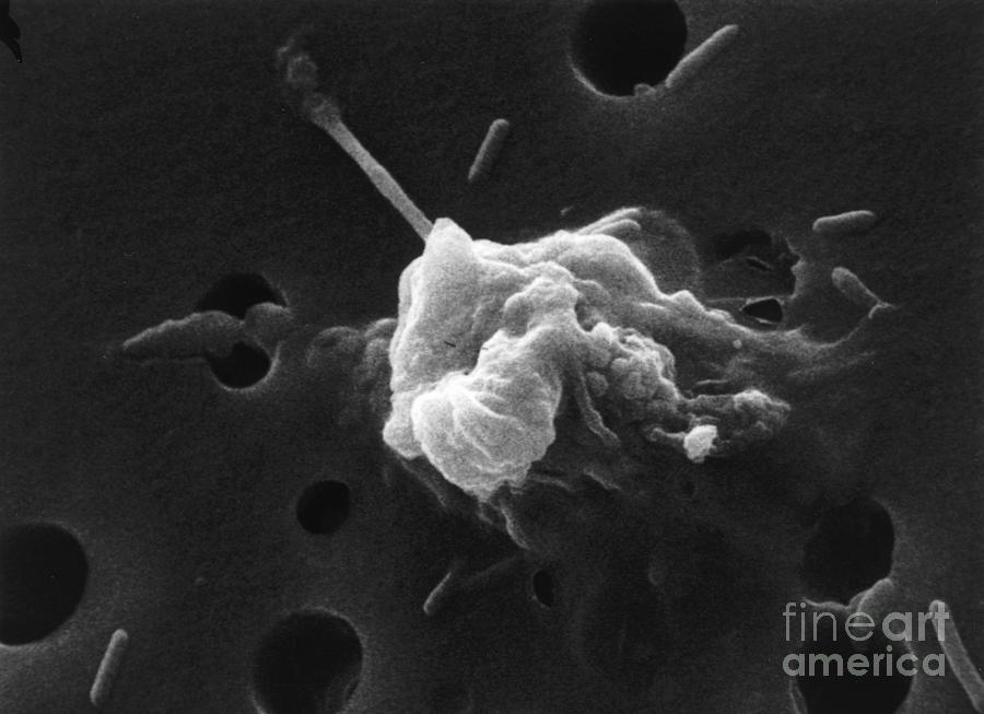 Cancer Cell Death, Sem 6 Of 6 #3 Photograph by Science Source