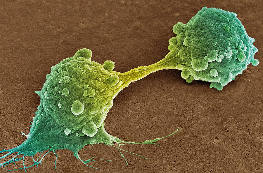 Cancer Cell Dividing, Sem Photograph by Steve Gschmeissner - Pixels