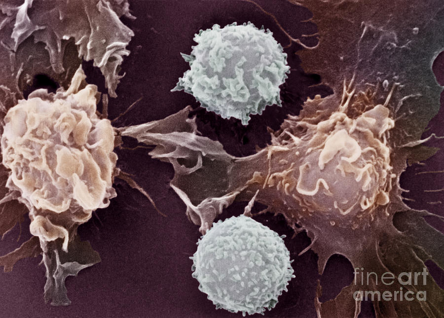 Cancer Cells #3 Photograph by Science Source